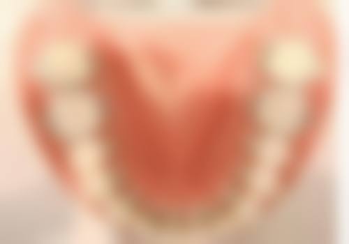 冷光美白为何见效快？