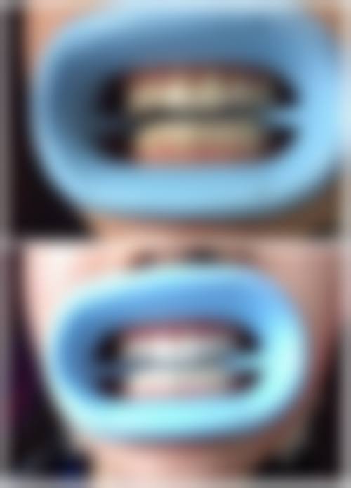 1、主要做的三大诊疗项目