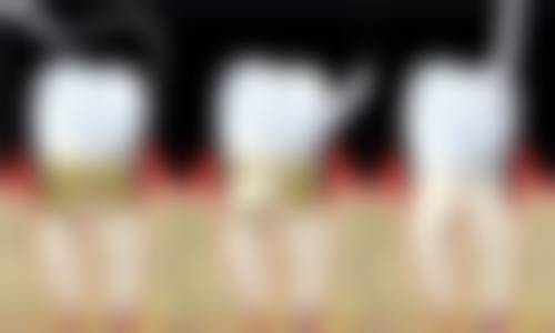 真实修复过程与不适时间线