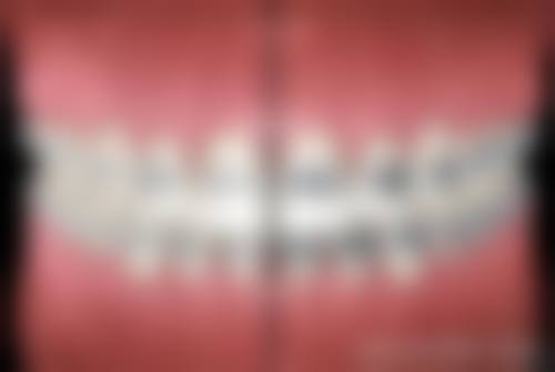 50 岁牙齿矫正常见误解与容易混淆的点