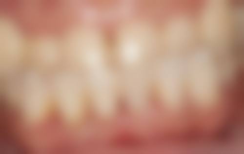 深圳市萨米国际医疗中心（市第四人民医院）口腔科在哪里预约挂号？线上公众号、现场窗口、电话0755-2158…都行！