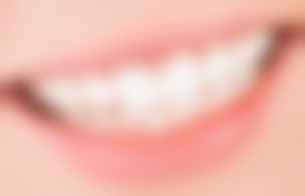 矫正嘴凸医院与医生选择中，哪些因素更关键？及医院医生推荐！