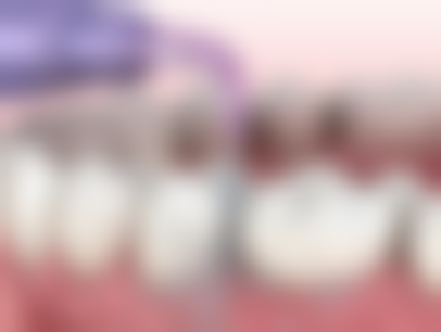 如果种植牙成效不理想，是否有补救与修复空间