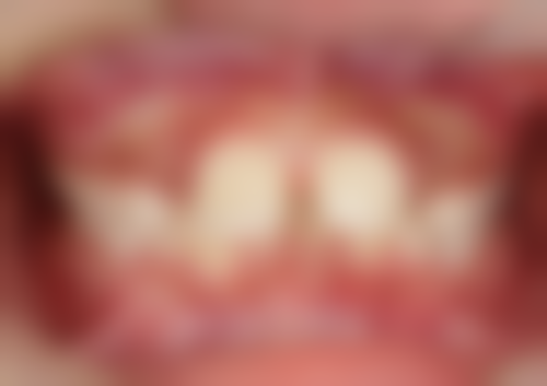 理性提醒：香港姊妹睇牙，安心永遠第一！