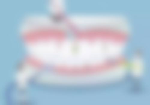 香港 澳门哪个牙科更好 价钱大比拼!澳门vs香港vs拱北口岸 边度更抵?