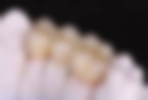 拓展延伸:牙科项目真相 + 避坑指南