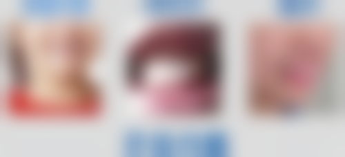 拓展延伸：牙科項目真相 + 關鍵選擇點 + 避坑指南