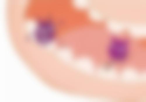 香港看牙術前術後避坑指南:湊仔媽咪/返工族必睇