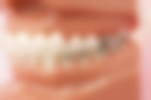 1. 点解香港人钟意去拱北整牙?三大原因直击痛点