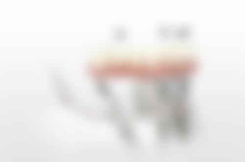 五、真实见证：中诺牙科医院口碑好吗？看过来人怎么说