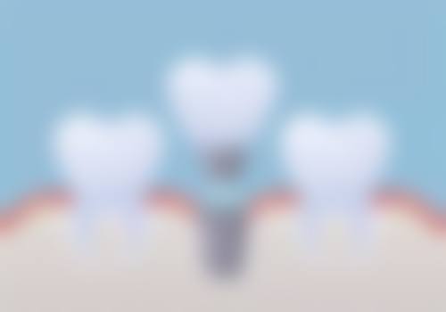 二、深度揭秘：中诺口腔医院是什么医院？正规可靠吗？