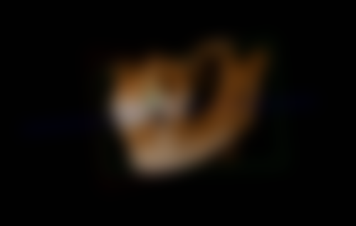 六、深圳市中医院牙科收费标准如何？看牙贵不贵？