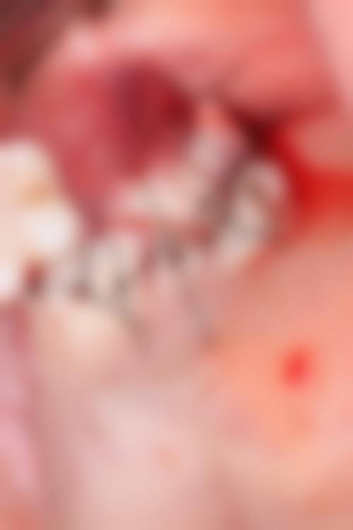 西安镶牙医院怎么选?关键看这3点,避免踩坑!