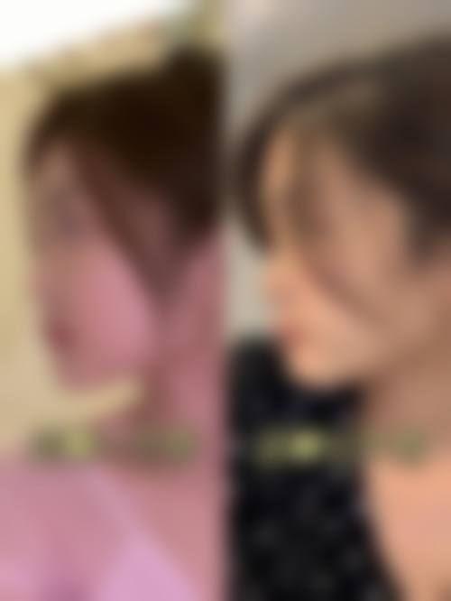 拱北口岸10分钟直达!香港人过珠海整牙有咩着数?