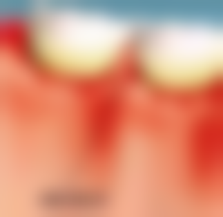 2. 拱北社保定点牙科,到底可以报销咩项目?