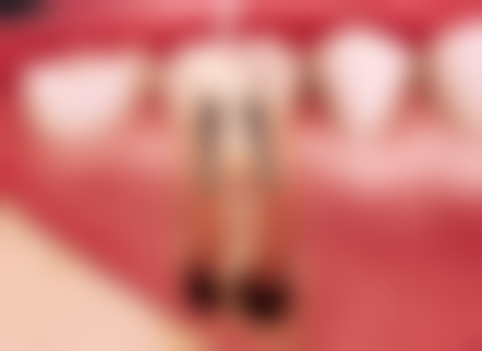 香港 香港大學深圳醫院牙科收費：適合邊類人群？