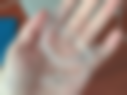 香港看牙醫多少錢？2026最新收費大公開！洗牙/補牙/脫牙收費一覽