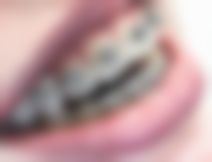 8. 2026年山西省中医院口腔科全口种植牙特色服务排名