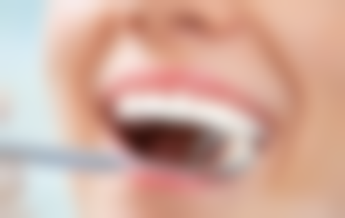 拓展延伸：格倫菲爾口腔項目真相+避坑指南