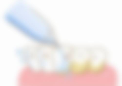 香港 麥芽口腔洗牙 邊間好?交通點去更方便?