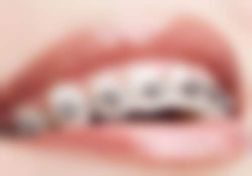 8、厦门思明港悦齿科口腔门诊部价格表/收费区间参考