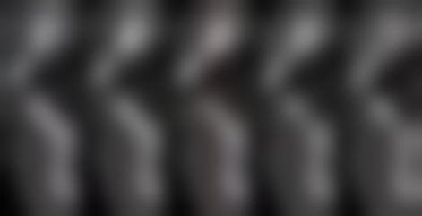 六、薛明慧主事擅长:你的牙齿矫正和种植牙方案如何定制?