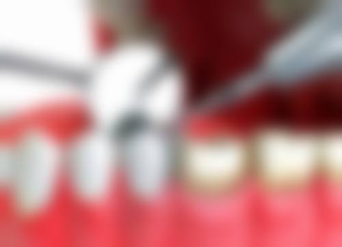 香港 麥芽口腔洗牙 真實體驗:2026全新流程