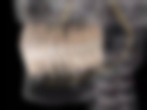 八、牙周炎治疗能用医疗保险报销吗?就诊费用常见问题解答