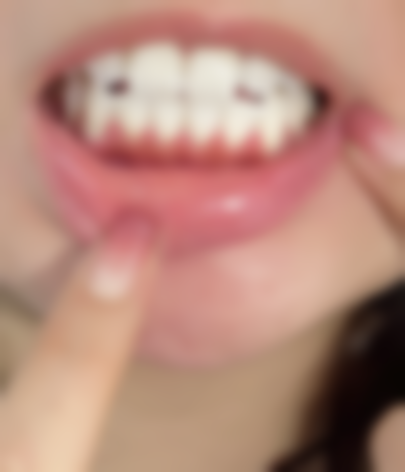 香港 格倫菲爾口腔好唔好 诊所拣选要点：3步避坑指南