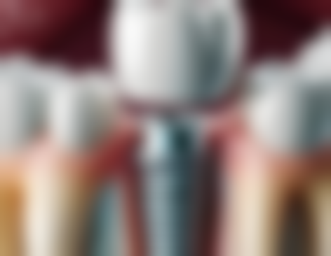 深圳牙科逸間好分最高2026排名top10！香港人推薦名醫診所種牙團購價2980起