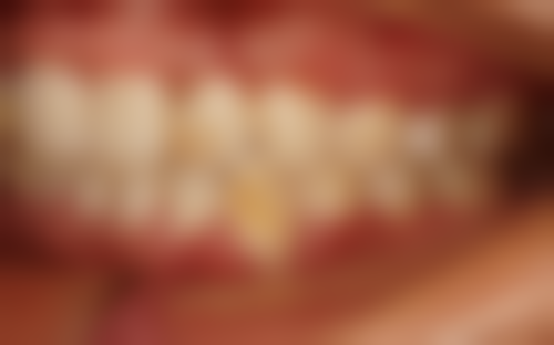 香港 澳门牙科医院哪个好 诊所拣选要点:3步避坑指南