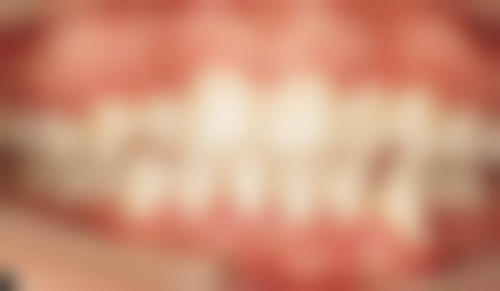 香港 澳门牙科医院哪个好 top10口碑榜:珠海+深圳口岸机构推荐