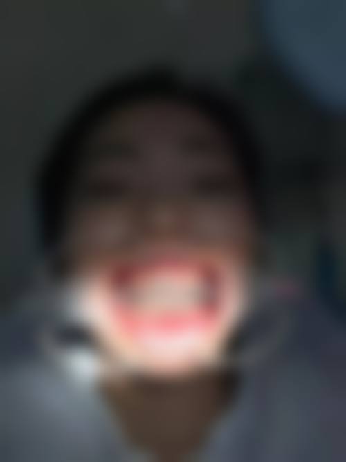 1、主要做的三大诊疗项目