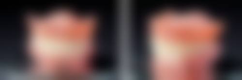 拓展延伸：種牙/矯正真相 + 避坑指南（香港姊妹必睇）