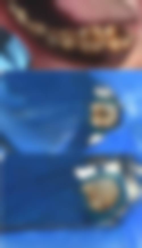 陈昭西医生根管治疗技术优势