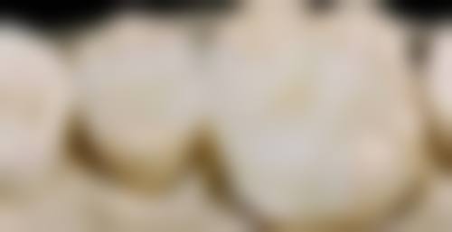 陈昭西医生手术成效