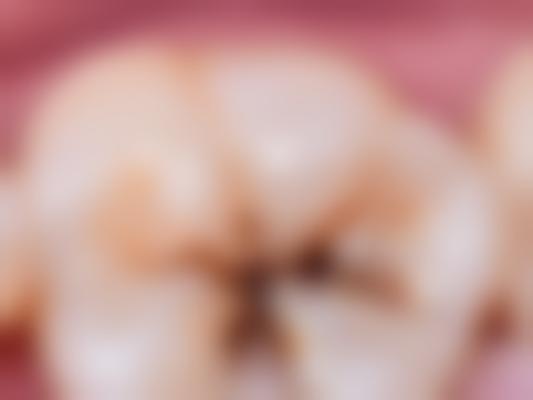 香港 種植牙收費 價錢範圍（HKD）：邊個部分更「食錢」？