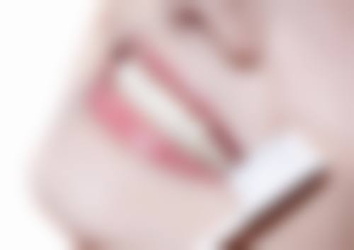 冷光牙齿美白仪有哪些优点和缺点？