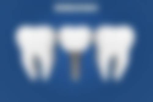 香港 澳门牙科医院排名前十 关键选择点：香港人专属指南