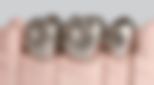 香港 澳门牙科医院排名前十 项目真相：你担心嘅问题都有答案！