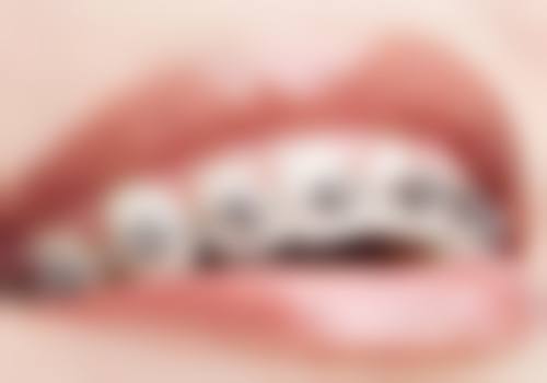 儿童牙龈肿拔牙有哪些精良技术？