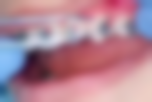 拓展延伸：拱北種牙常見問題解答（香港人更關心）