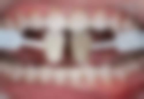 2026深圳睇牙lihkg攻略｜边间牙科最平？附收费价目+医生推荐+预约攻略！