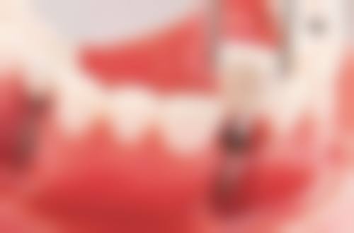 香港 珠海拱北牙科哪里好 必睇3间诊所实测