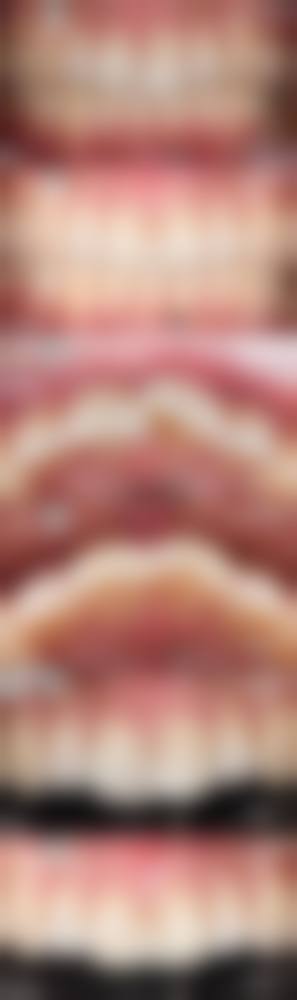 选对医院医生，是种植牙成功的核心保护！