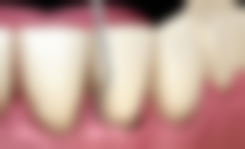 香港 麥芽口腔排名 深圳8大分院地址：邊間近口岸？交通指南！