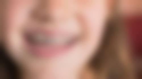 香港 麥芽口腔排名 網上預約有優惠！3步搞掂，仲有港客禮包！