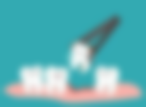 全身健康状况对拔牙后种植牙时长的影响