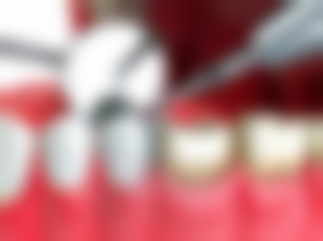 三、张洲医生技术水平高吗？