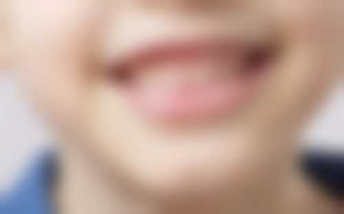 种植牙怎么选择医院医生及国内医院医生推荐